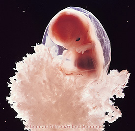 Qué es el latido fetal: el signo de confirmación que marca un antes y un  después para el embarazo